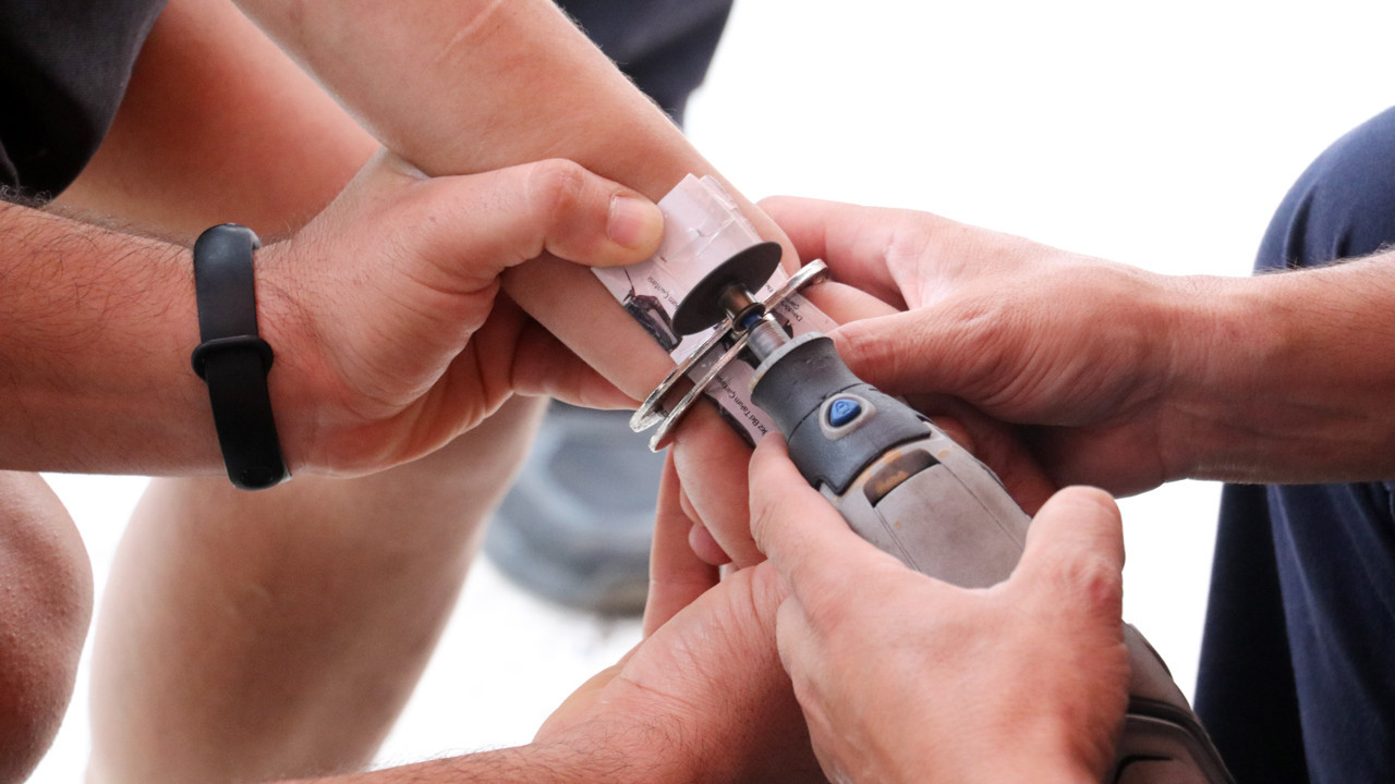 Bileğindeki kelepçe yüzük kesme aparatıyla çıkarıldı