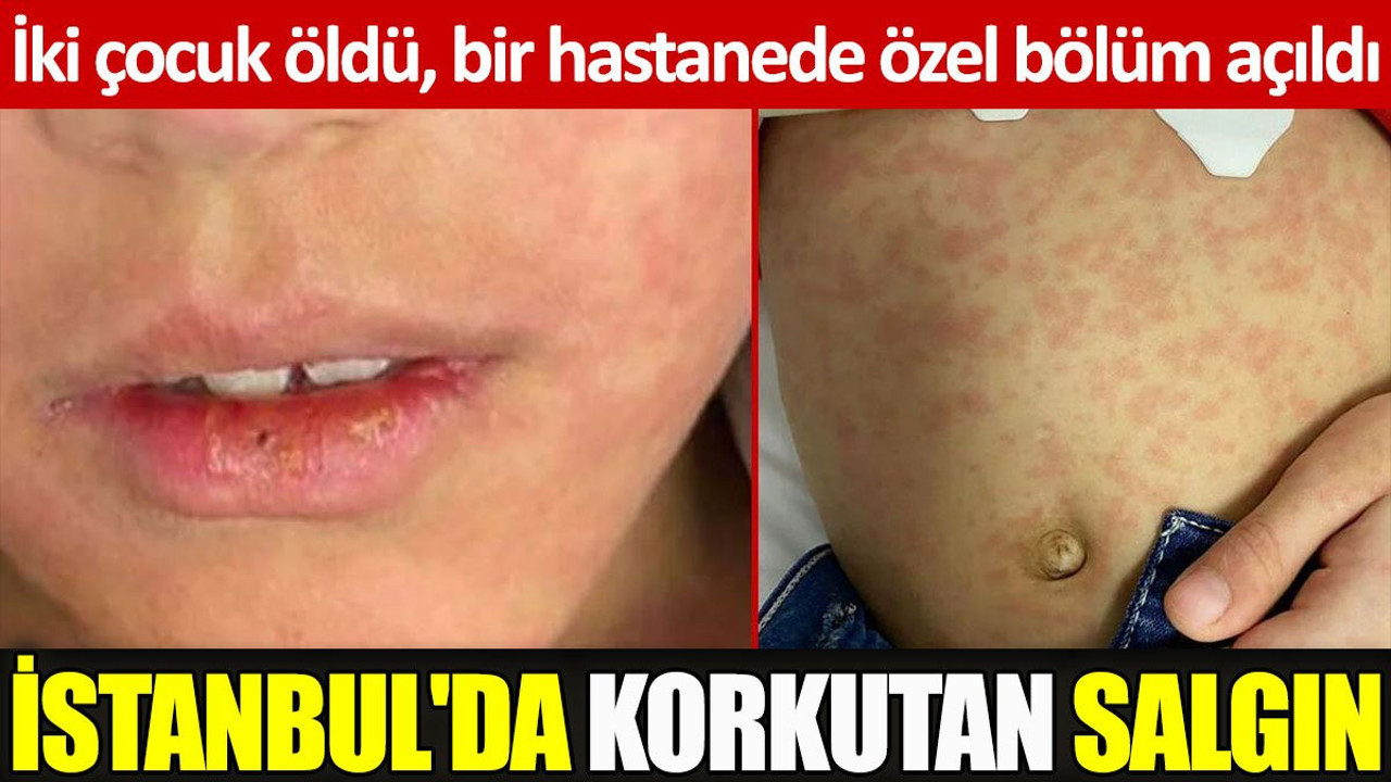 İstanbul'da korkutan salgın: İki çocuk öldü, hastanede özel bölüm açıldı