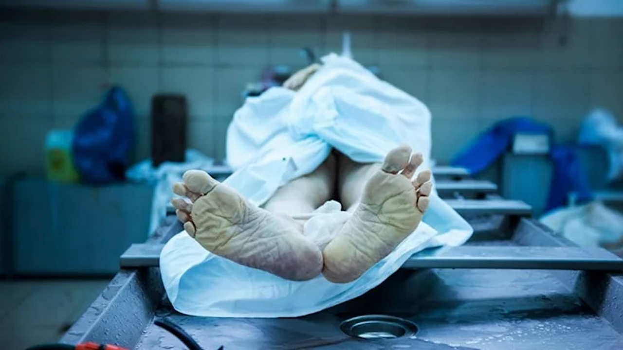 Ünlü üniversitede büyük skandal. Kafa, beyin ve kemikleri satmışlar