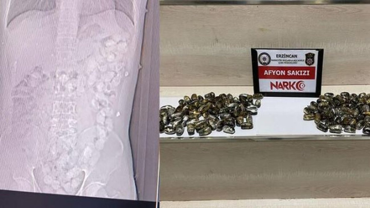 Midelerinde uyuşturucu taşıyan 2 İranlı tutuklandı