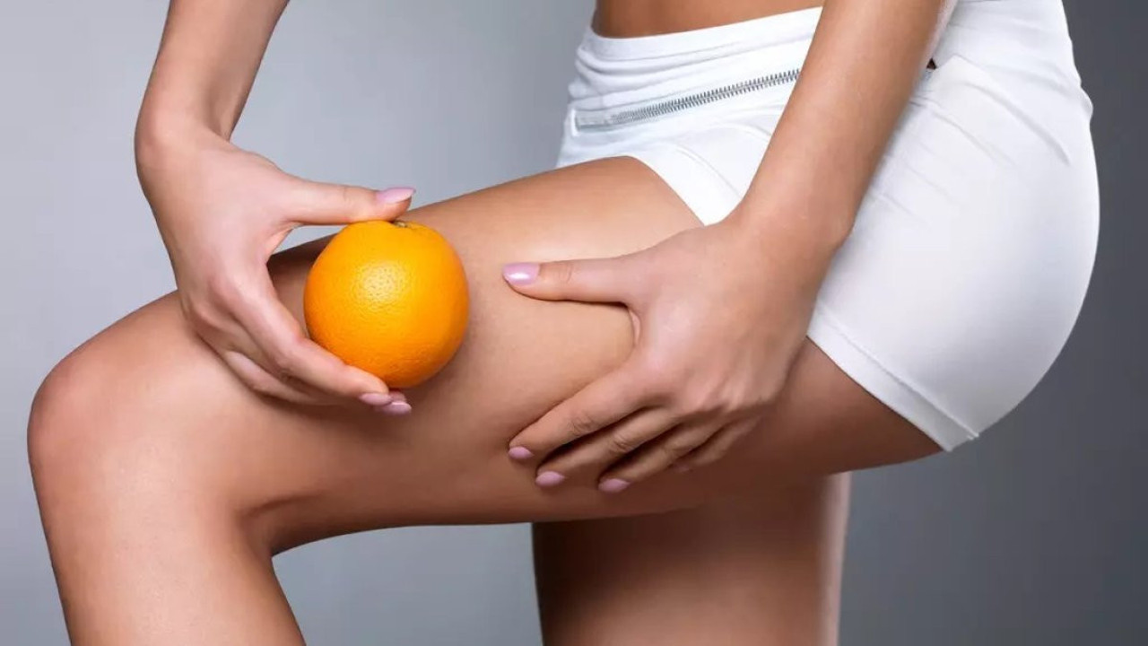 Yaz geldi kadınların korkulu rüyasına mucize çözüm. 1 haftada selülitü yok etmek için ne yapılır?