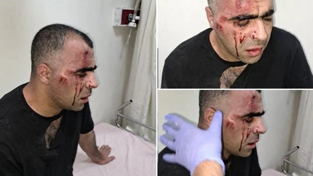 Yolsuzluk haberi yaptığı için belediye başkanının dövdürdüğü gazeteci yeni bombayı patlattı