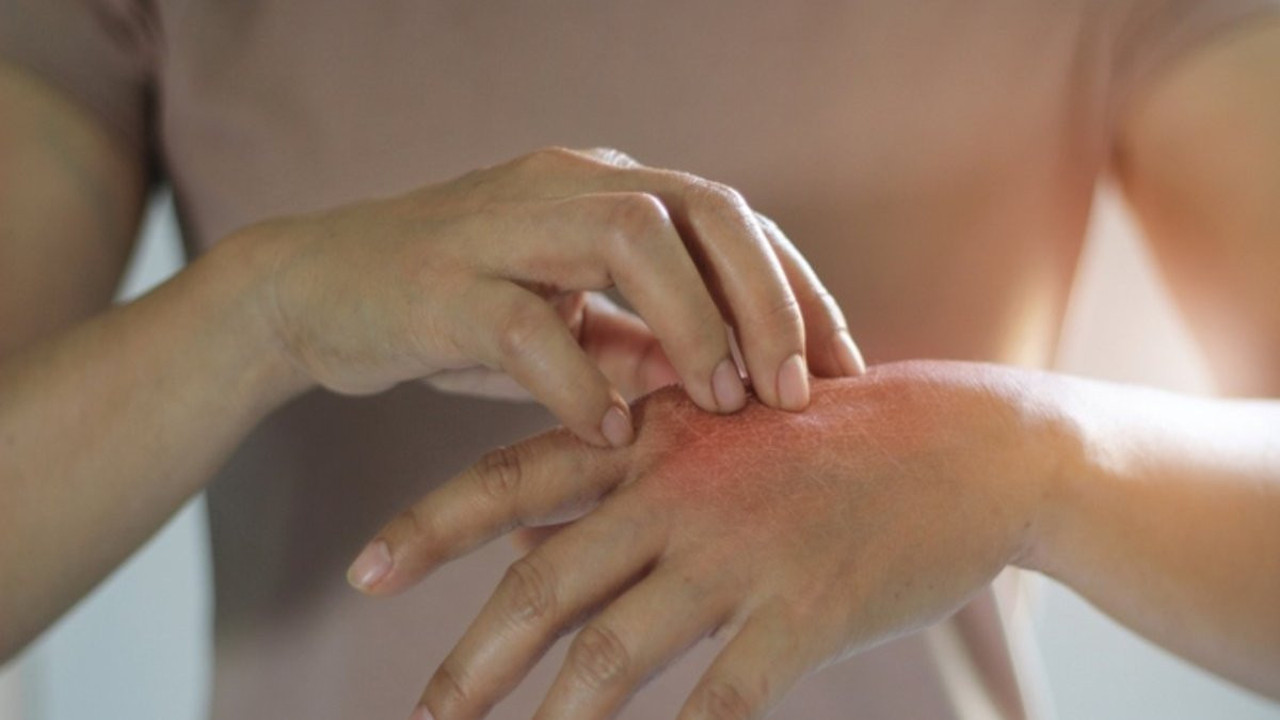 Ciltteki yaralara iyi gelen ot