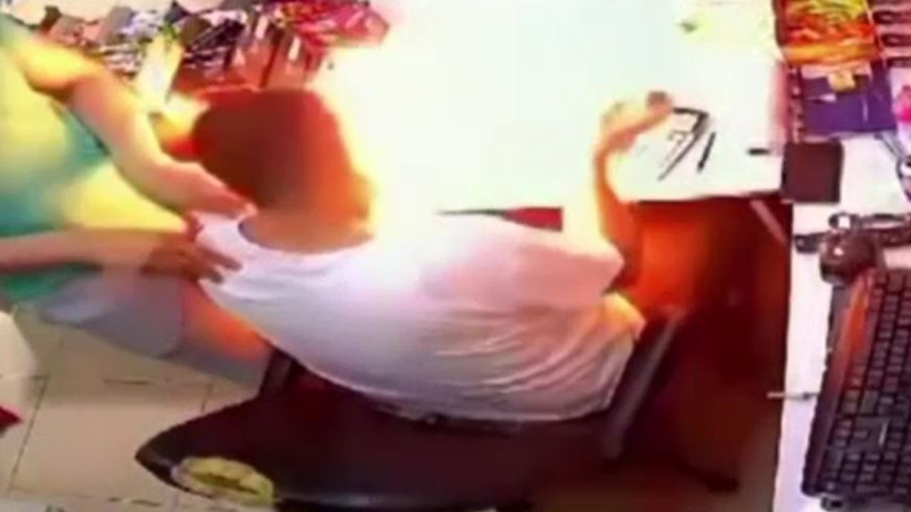 Çakmağa gaz doldururken yandı