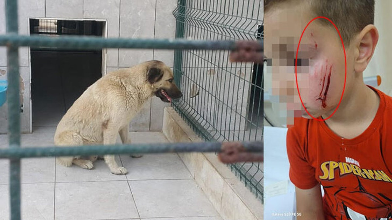 Sokak köpeği 7 yaşındaki Umut’un yüzünü parçaladı