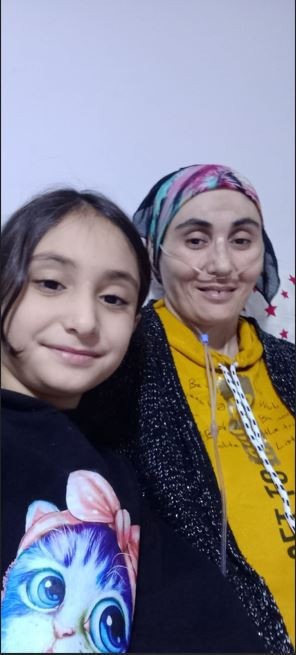 Bir ailenin acısı başka bir aileyi kurtardı: Beyin ölümünden doğan hayat! - Resim : 2