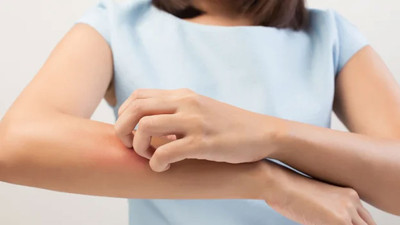 Uzmanlardan 'kaşınma'yla ilgili kritik öneri! Delirmemek için bunu sakın yapmayın