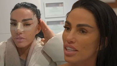 Neşter altında saklanan dram! Kusursuzluk arayışı estetik bağımlılığını tetikliyor