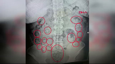 Aksaray'da film gibi operasyon! Zehri midesinde sakladı: Polis durdurunca gerçek ortaya çıktı