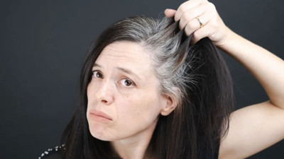 Genç yaşta gelen beyazlara bilimsel bakış! Geri dönüş mümkün mü?