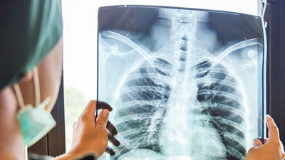 Zatürreye karşı 'görünmez kalkan' oluyor! Uzmanlar üç mucizeye işaret etti