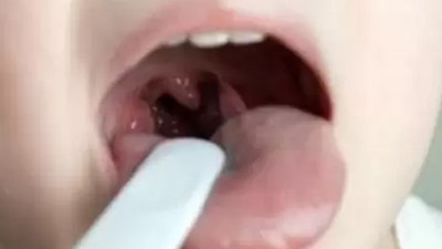 Her bademcik sorunu kötü demek değil! Uzmanlar anlattı