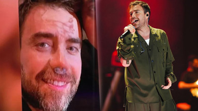 Ünlü şarkıcı Murat Dalkılıç'ın son hali hayranlarını endişelendirdi! 12. kez bıçak altına mı yattı?