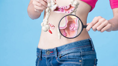 Bağırsak kanseri alarmı! Bilim dünyası işlenmiş gıdaları işaret etti