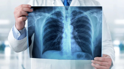 Akciğerdeki gizemli tehlike bilim dünyasını alarma geçirdi