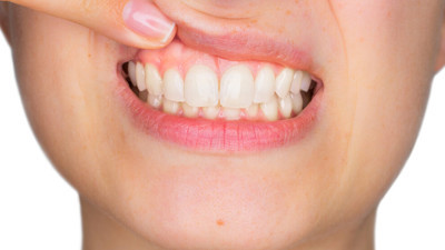 Ağızdaki saatli bomba ölüm saçıyor