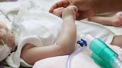 Protokol imzalandı! SMA tedavisinde kullanılan ilaç Türkiye'de üretilecek