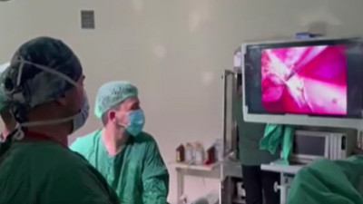 Doktorlar çıkan taşları saymakta zorlandı! Rekoru yapay zeka açıkladı