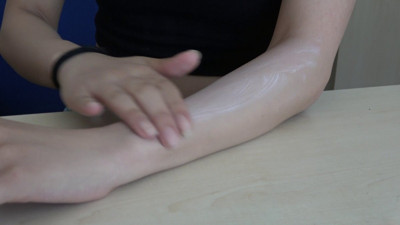 Güneş yanıklarına sakın böyle müdahale etmeyin. Uzmanı uyardı