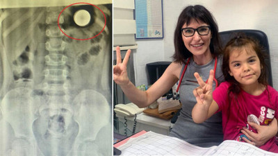 5 yaşındaki Irmak para yuttu. Mucize kurtuluş herkesi şaşkına çevirdi