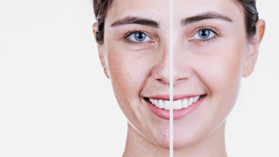 Yaşlanma tarihe karışacak. ‘Zombi hücreleri’ yok eden keşif