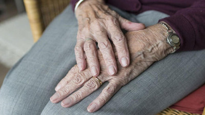 Ellerdeki o kırışıklıklar neden olur