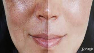 Cild kuruması beraberinde başka sorunlar yaratır