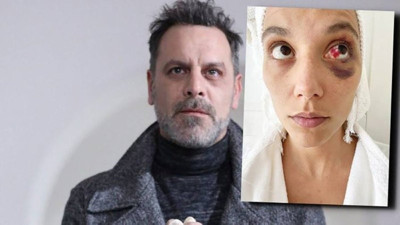 Ozan Güven'in şiddet uyguladığı Deniz Bulutsuz'un adli tıp raporu ortaya çıktı