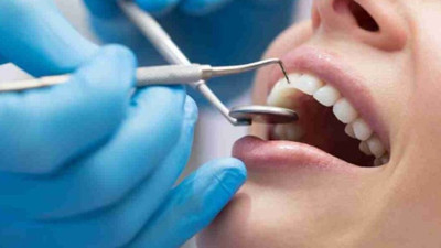 Dişlere vitamin şart