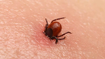 Vücuduna yapışan keneyi çıkardı. Canından oldu