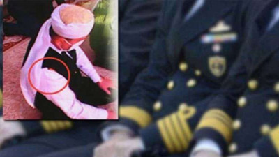 Sarıklı amirale dokundu yandı