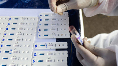 Güney Afrika'da Kovid-19'un yeni varyantı Eris vakası tespit edildi