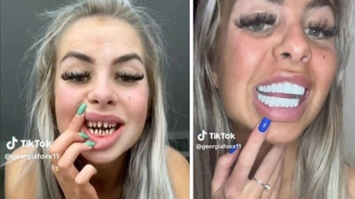 İngiliz fenomen Georgia Fox dişlerini paylaştı: Türkiye'yi öve öve bitiremedi