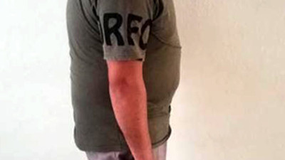 Erkeklerde 3 kat fazla görülüyor. Uzmanı uyardı