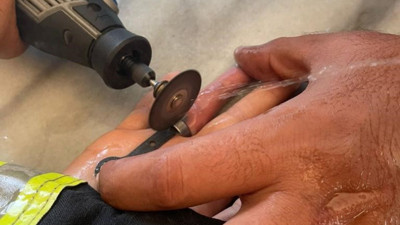 Parmağına sıkışan yüzüğü itfaiye ekipleri çıkardı