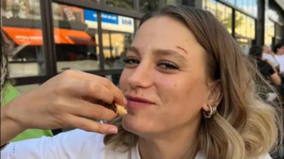 Serenay Sarıkaya’nın kaşındaki yara izinin nedeni belli oldu. Gerçek bambaşka çıktı