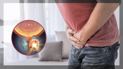 Prostat kanserinde hayat kurtaran 4 öneri
