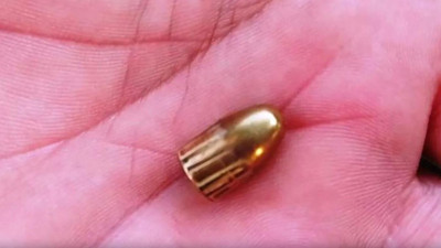 Fındık bahçesinde 2 kişi yorgun mermi ile yaralandı