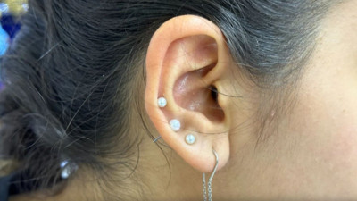 Sakın böyle kulak deldirmeyin. Tehlikesi büyük