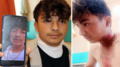 Korkunç olay: Boynundaki kolyeye 'yıldırım' düştü