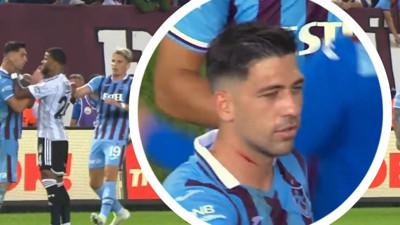 Rosier boğazını sıkmıştı. Bakasetas'ın röportajdaki görüntüsü gündem oldu