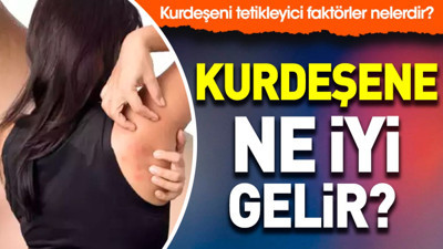 Kurdeşene ne iyi gelir? Kurdeşeni tetikleyici faktörler nelerdir?