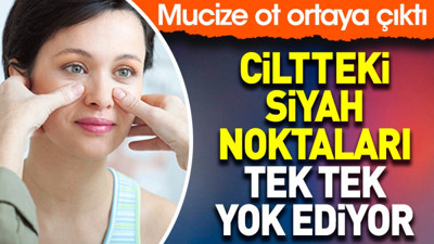 Ciltteki siyah noktaları tek tek yok ediyor. Mucize ot ortaya çıktı