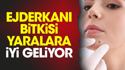 Yaralara iyi gelen bitki (05 Ekim 2023)