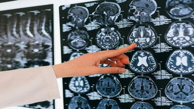 Uzmanından kritik serebral palsili çocuklar uyarıları