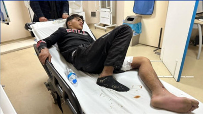 Bozayı saldırısına uğrayan 16 yaşındaki çocuk yaralandı