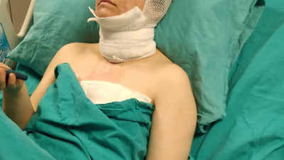 Eski eşinin yüzüne kezzap atan adama komik ceza