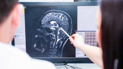 İnsan beyninde şaşırtan keşif. Beynin bilinmeyen özelliği ortaya çıktı