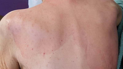 Huzurevinde korkunç ölüm. Rapor sonucu şok etti: Yaşlı kadını yakmışlar