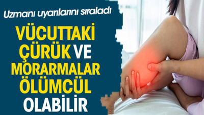 Uzmanı uyarılarını sıraladı. Vücuttaki çürük ve morarmalar ölümcül olabilir